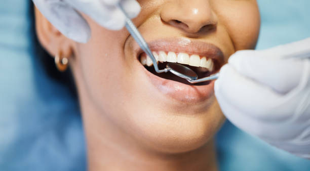 Best Emergency Treatment for Dental Infections or Abscesses in Wagener, SC