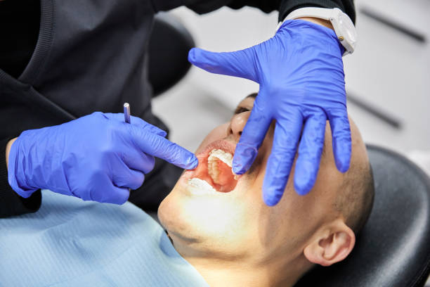 Best Urgent Care for Lost Fillings or Crowns in Wagener, SC